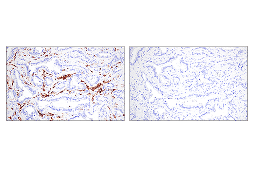 Immunohistochemistry Image 6: Iba1/AIF-1 (E4O4W) XP<sup>®</sup> Rabbit mAb (BSA and Azide Free)