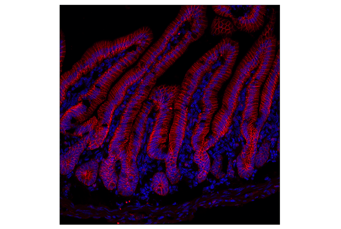 Immunofluorescence Image 1: E-Cadherin (24E10) Rabbit mAb (Alexa Fluor<sup>®</sup> 594 Conjugate)