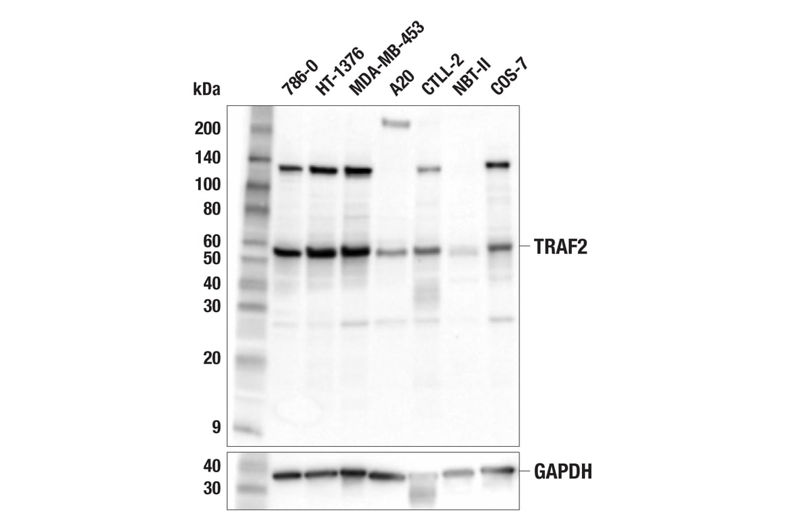 Western Blotting Image 1: TRAF2 (F2Y7K) Rabbit mAb