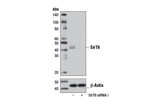 undefined Image 1: SignalSilence<sup>®</sup> SirT6 siRNA I