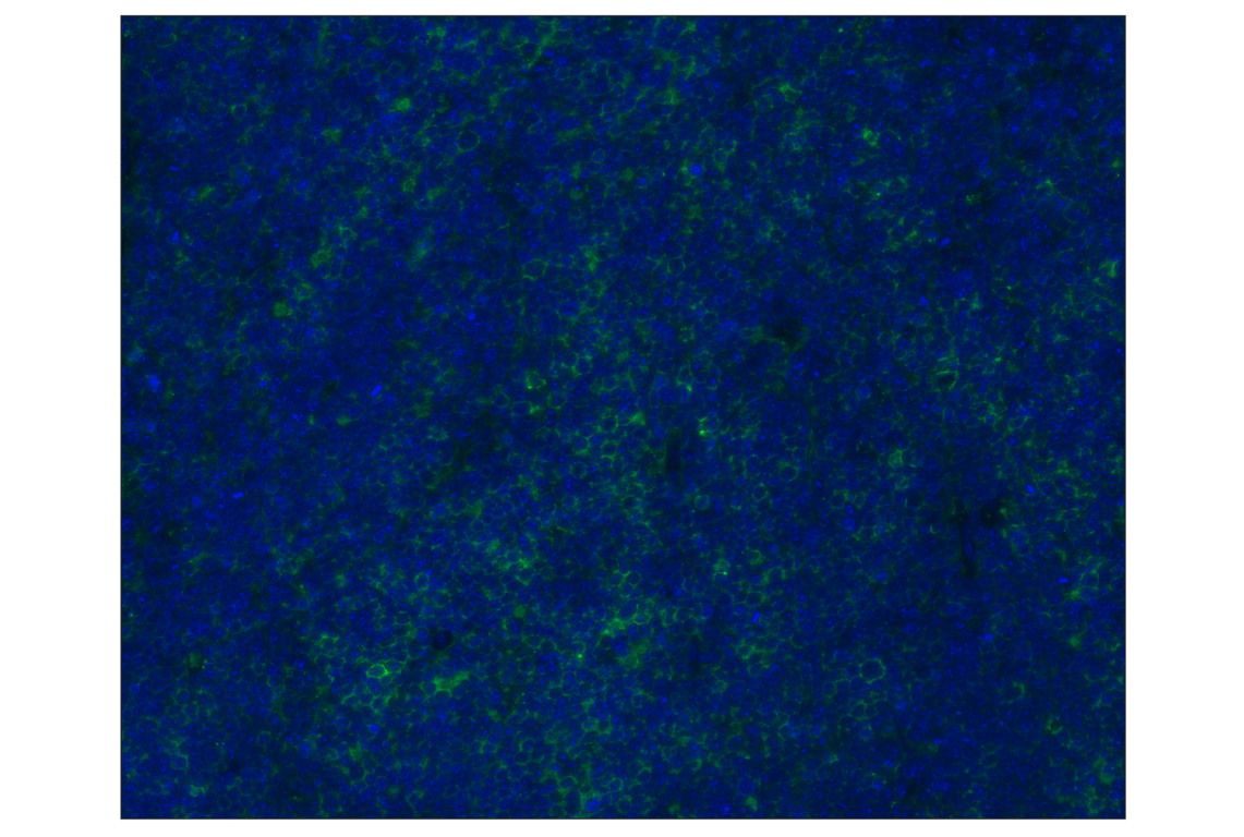 Immunohistochemistry Image 1: PD-L1 (D5V3B) Rabbit mAb (Alexa Fluor<sup>®</sup> 488 Conjugate)