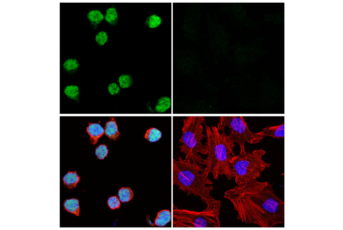 Immunofluorescence Image 1: EOMES (D8D1R) Rabbit mAb (Alexa Fluor<sup>®</sup> 488 Conjugate)