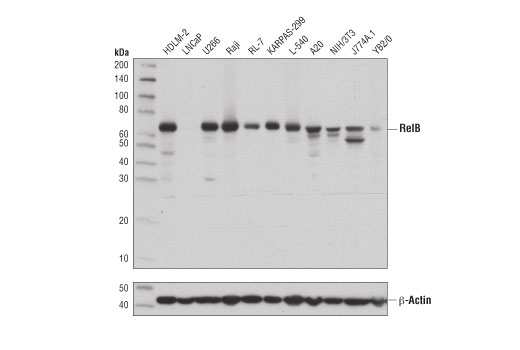 Western Blotting Image 1: RelB (D7D7W) Rabbit mAb