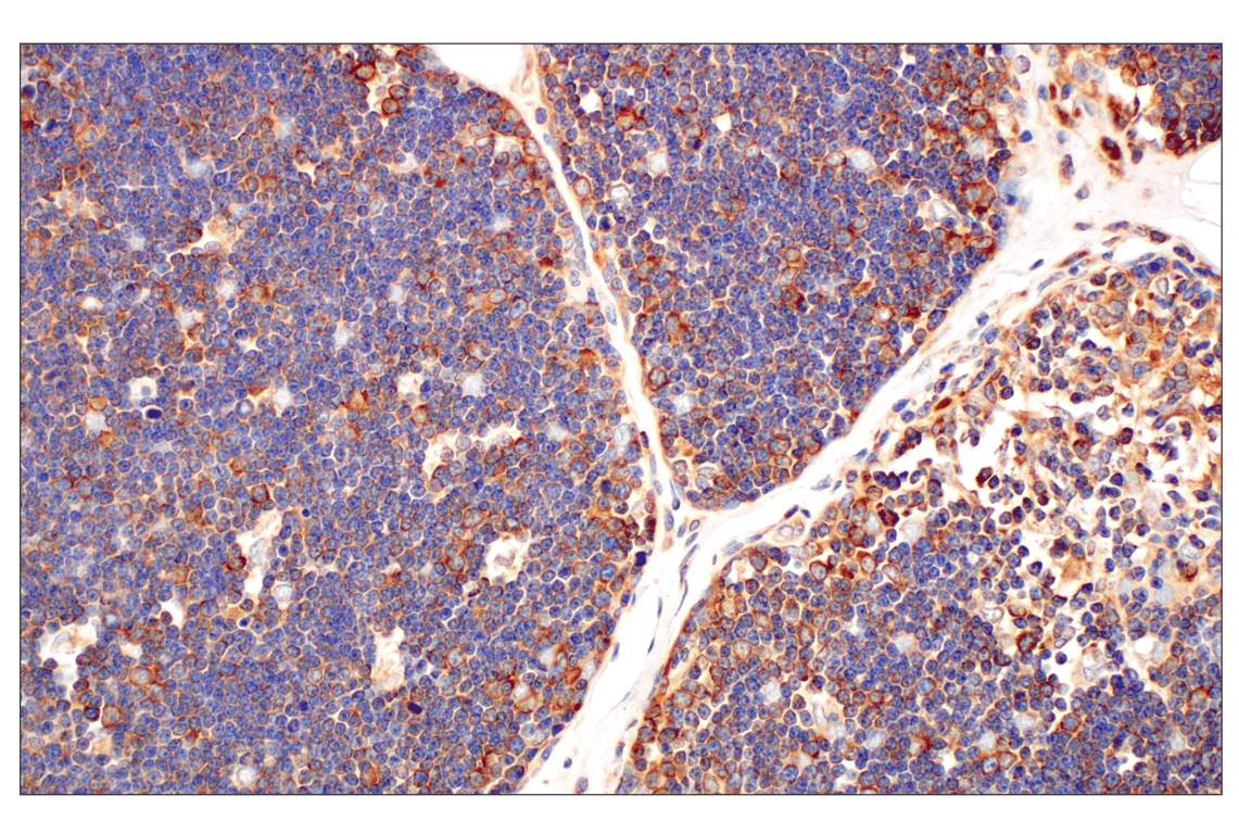 Immunohistochemistry Image 5: RACK1 (D59D5) Rabbit mAb