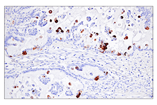 Immunohistochemistry Image 2: Keratin 5 (E2T4B) XP<sup>®</sup> Rabbit mAb