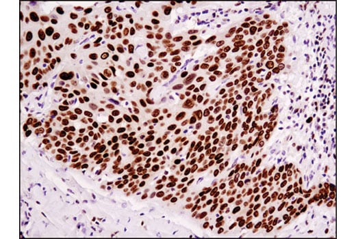 Immunohistochemistry Image 1: HMGA1 (D4F8) Rabbit mAb