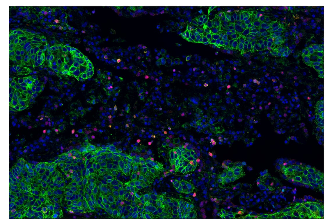 Immunohistochemistry Image 1: Tox/Tox2 (E6I3Q) & CO-0016-750 SignalStar<sup>™</sup> Oligo-Antibody Pair