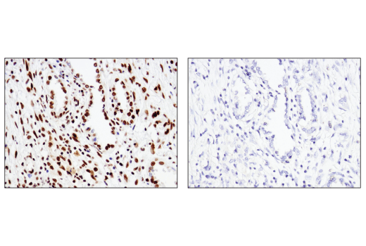 Immunohistochemistry Image 4: ATF-2 (D4L2X) XP<sup>®</sup> Rabbit mAb (BSA and Azide Free)