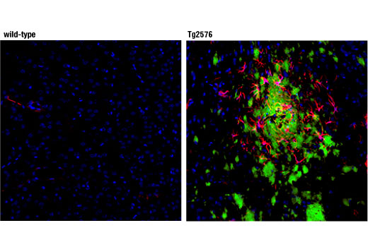 Immunofluorescence Image 1: β-Amyloid (D54D2) XP<sup>®</sup> Rabbit mAb (Alexa Fluor<sup>®</sup> 488 Conjugate)