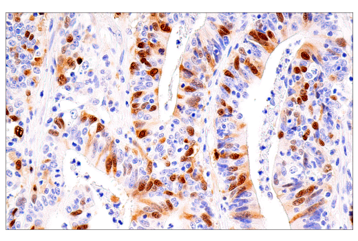 Immunohistochemistry Image 5: Cyclin A2 (E6D1J) XP<sup>®</sup> Rabbit mAb (BSA and Azide Free)