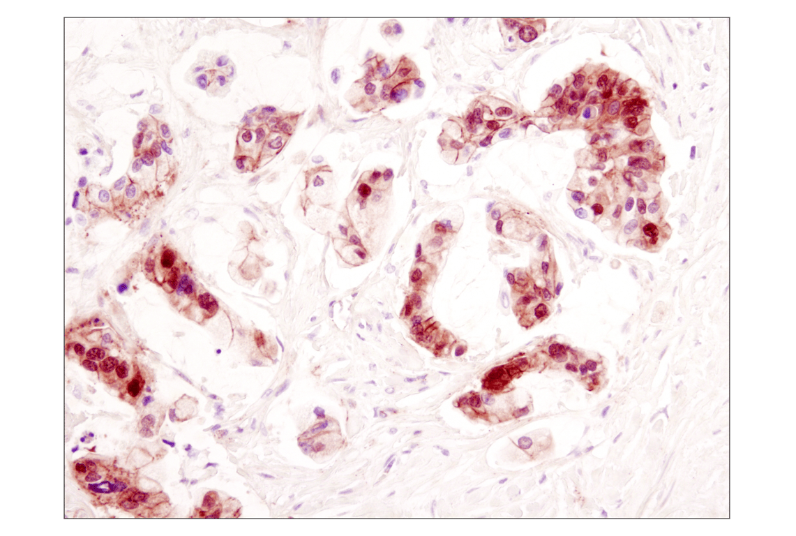 Immunohistochemistry Image 2: β-Catenin (D10A8) XP<sup>®</sup> Rabbit mAb (BSA and Azide Free)