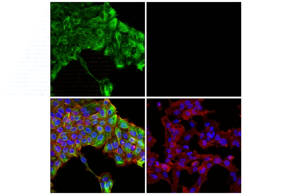 Immunofluorescence Image 1: Keratin 14 (E7W6V) Rabbit mAb