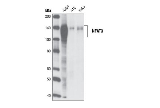 Western Blotting Image 1: NFAT3 (23E6) Rabbit mAb