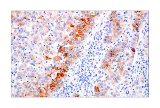 Immunohistochemistry Image 3: ACE2 (OTI1G4) Mouse mAb