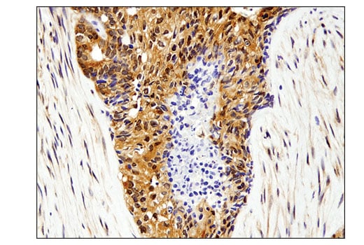 Immunohistochemistry Image 3: Akt1 (D9R8K) Rabbit mAb