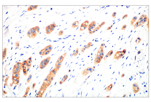 Immunohistochemistry Image 1: HER3/ErbB3 (D22C5) XP<sup>®</sup> Rabbit mAb