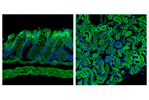 Immunofluorescence Image 1: Ras (E4K9L) Rabbit mAb (Alexa Fluor<sup>®</sup> 488 Conjugate)