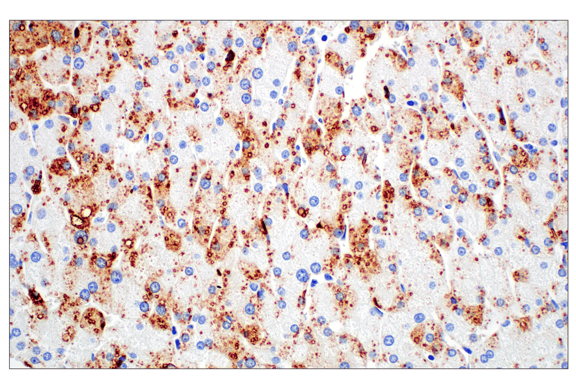 Immunohistochemistry Image 14: Perilipin-2 (E6G6M) Rabbit mAb