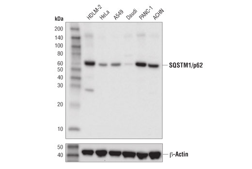 undefined Image 17: Human Reactive Cell Death and Autophagy Antibody Sampler Kit