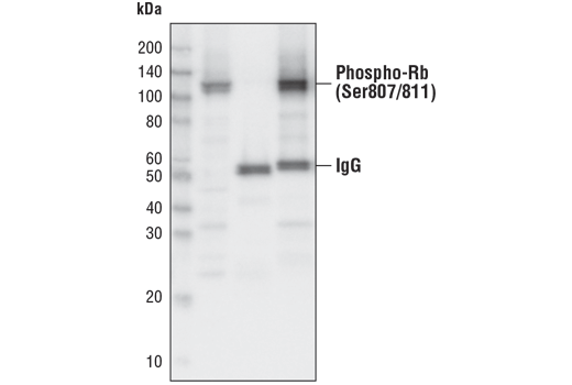Immunoprecipitation Image 1: Phospho-Rb (Ser807/811) (D20B12) XP<sup>®</sup> Rabbit mAb