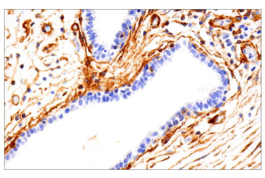 Immunohistochemistry Image 3: Integrin α1/CD49a (E9K2J) XP<sup>®</sup> Rabbit mAb (BSA and Azide Free)