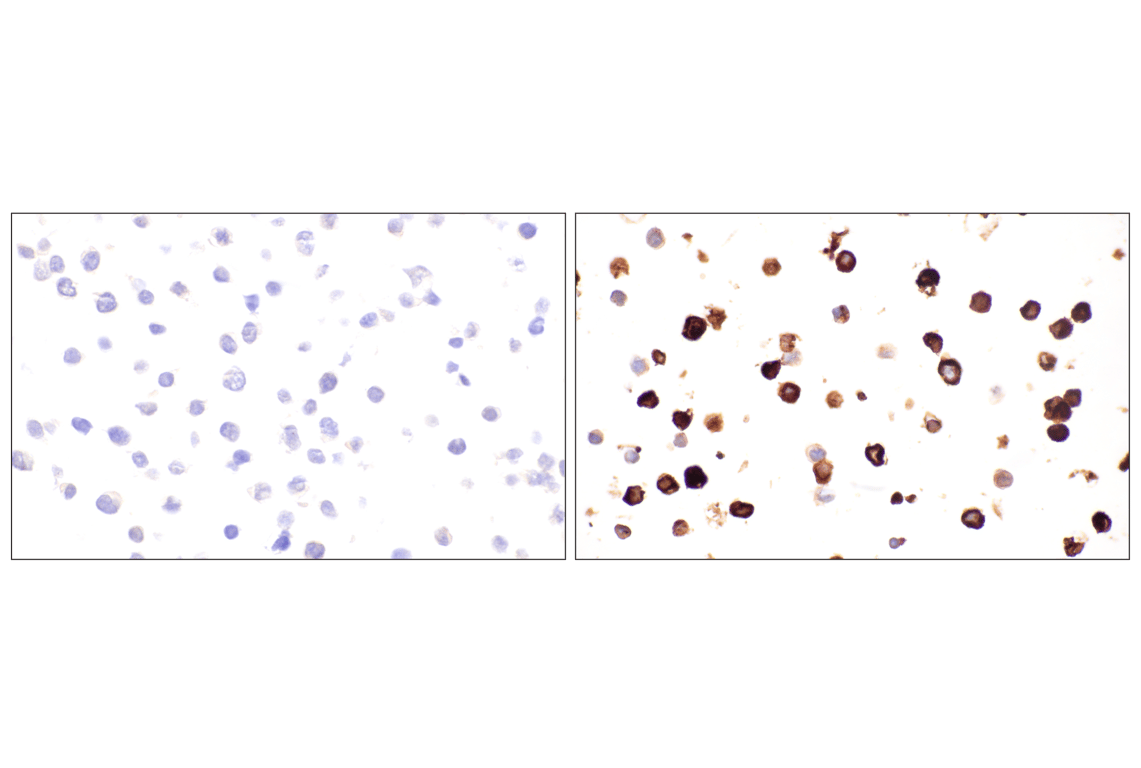 Immunohistochemistry Image 10: DPEP-1/MDP (E5H7T) Rabbit mAb