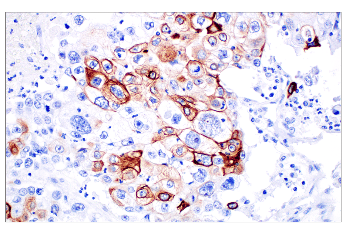 Immunohistochemistry Image 3: Keratin 14 (E7W6V) Rabbit mAb