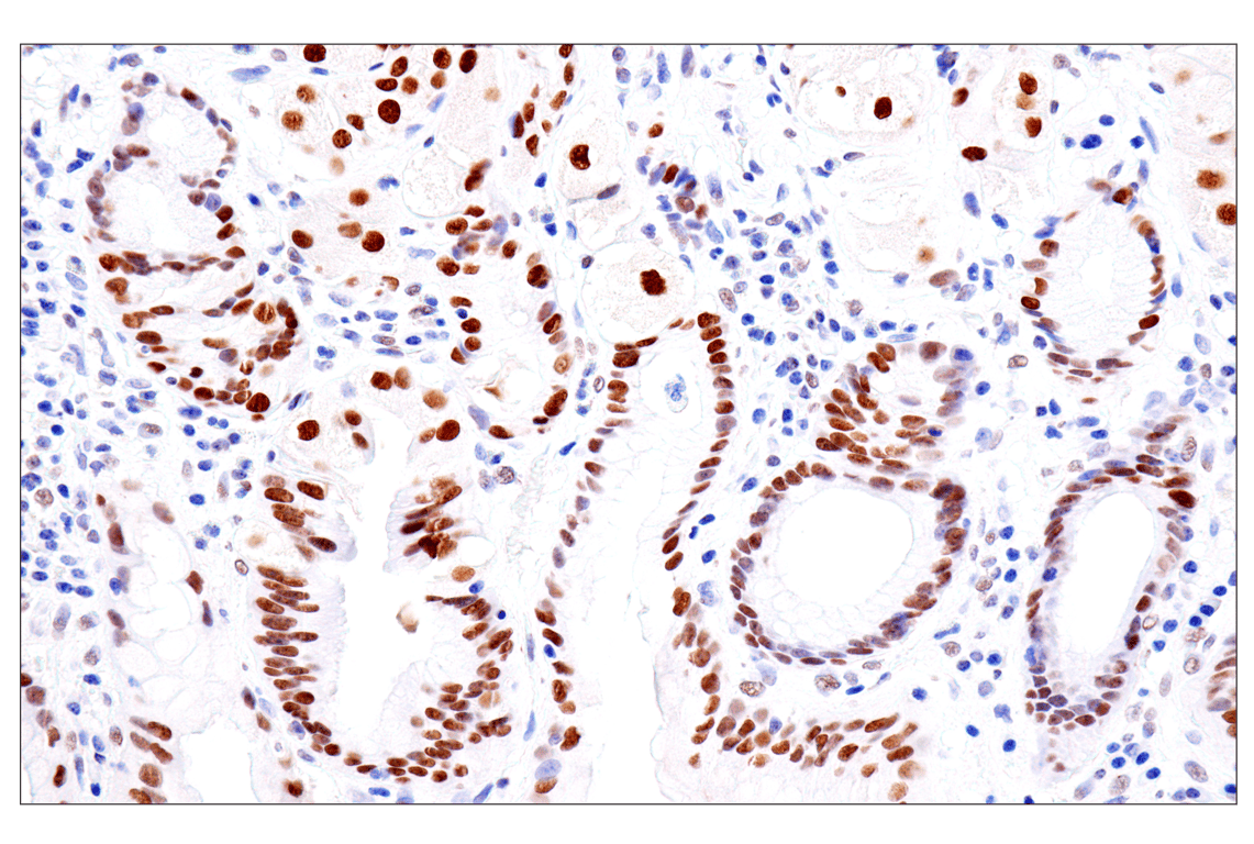 Immunohistochemistry Image 16: FoxA1/HNF3α (IHC578) Mouse mAb