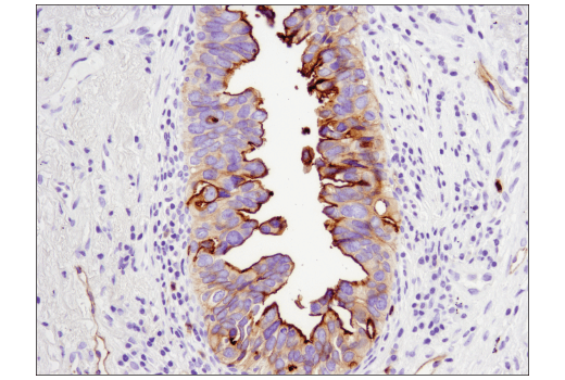 Immunohistochemistry Image 2: CEACAM1 (D3R8O) Rabbit mAb