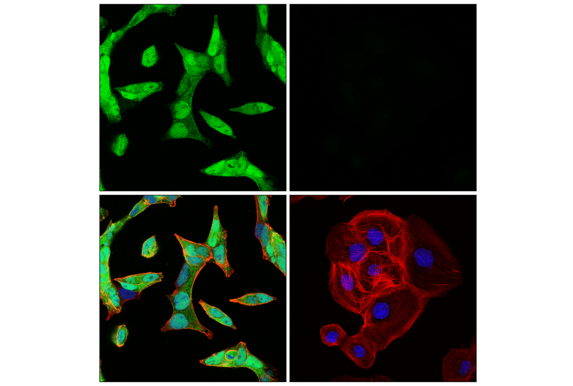 Immunofluorescence Image 1: Androgen Receptor (E3S4N) Rabbit mAb (Carboxy-terminal Antigen)