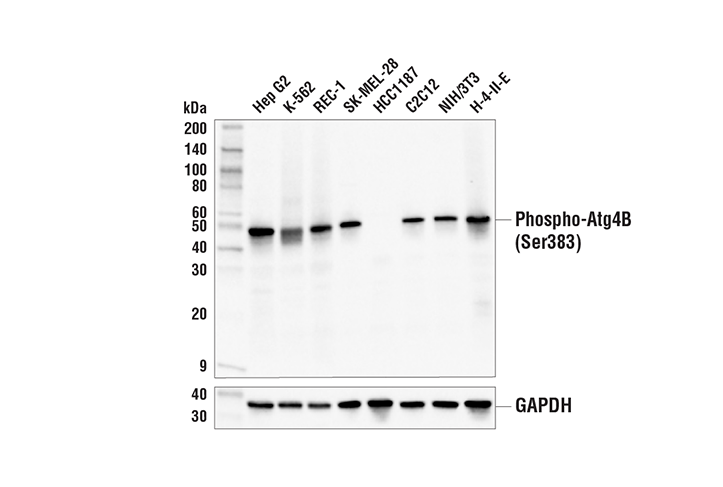 Western Blotting Image 2: Phospho-Atg4B (Ser383) (E3I8M) Rabbit mAb