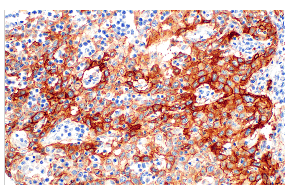 Immunohistochemistry Image 3: Integrin β6 (E4M9P) XP<sup>®</sup> Rabbit mAb
