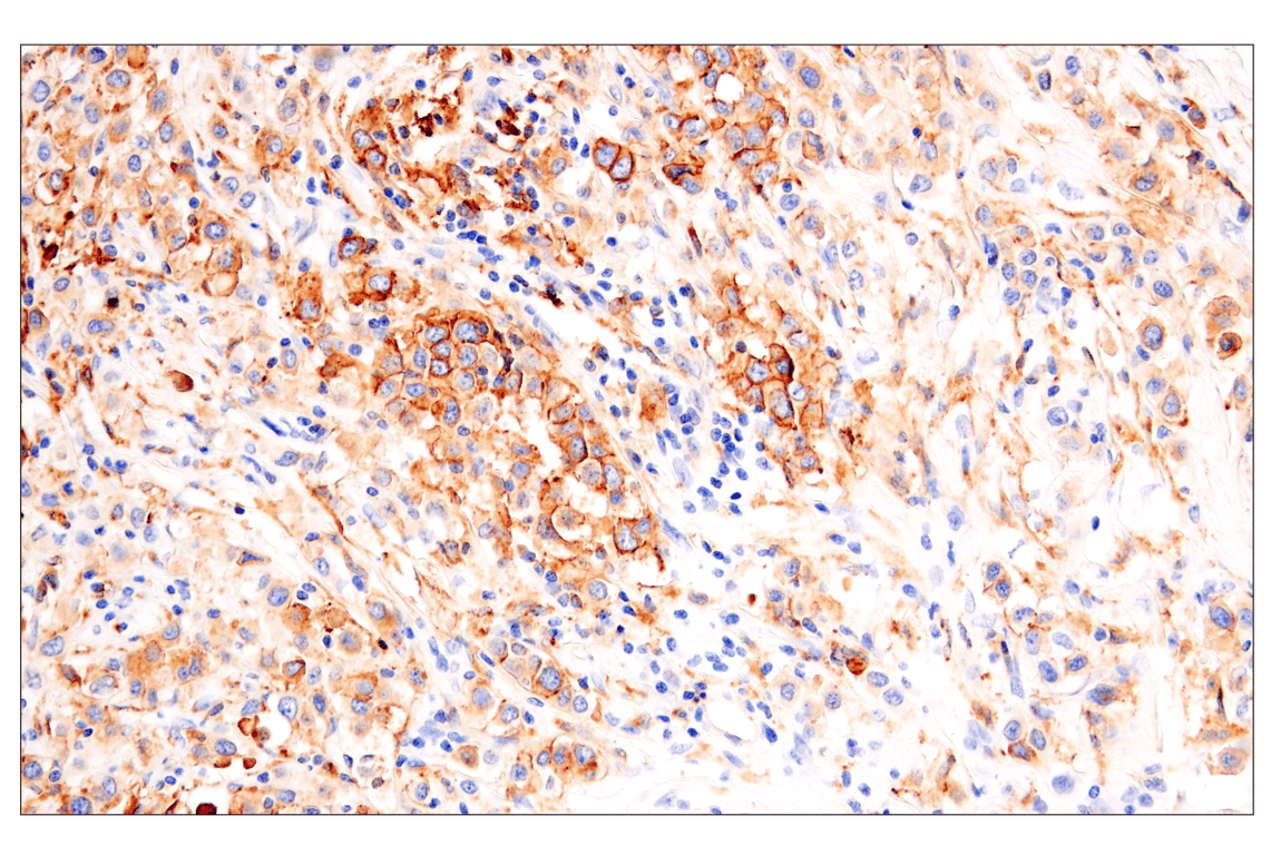 Immunohistochemistry Image 1: HLA-DRA (E9R2Q) XP<sup>®</sup> Rabbit mAb