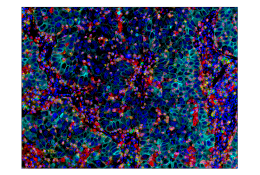 Immunohistochemistry Image 5: TIM-3 (D5D5R<sup>™</sup>) XP<sup>®</sup> Rabbit mAb (BSA and Azide Free)