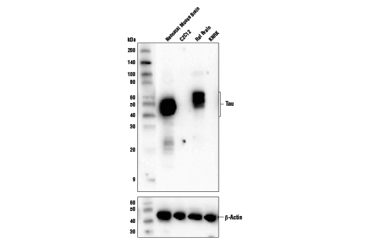 Western Blotting Image 1: Tau (D1M9X) XP<sup>®</sup> Rabbit mAb (BSA and Azide Free)