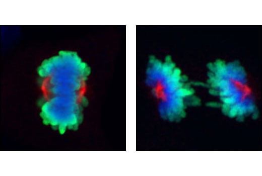 Immunofluorescence Image 1: Aurora A/AIK (1G4) Rabbit mAb