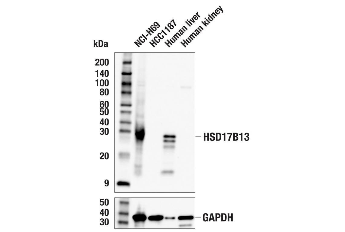 Western Blotting Image 1: HSD17B13 (E5K7Q) Rabbit mAb