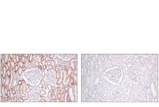 Immunohistochemistry Image 2: Semaphorin-4D/CD100 (E5C3B) XP<sup>®</sup> Rabbit mAb