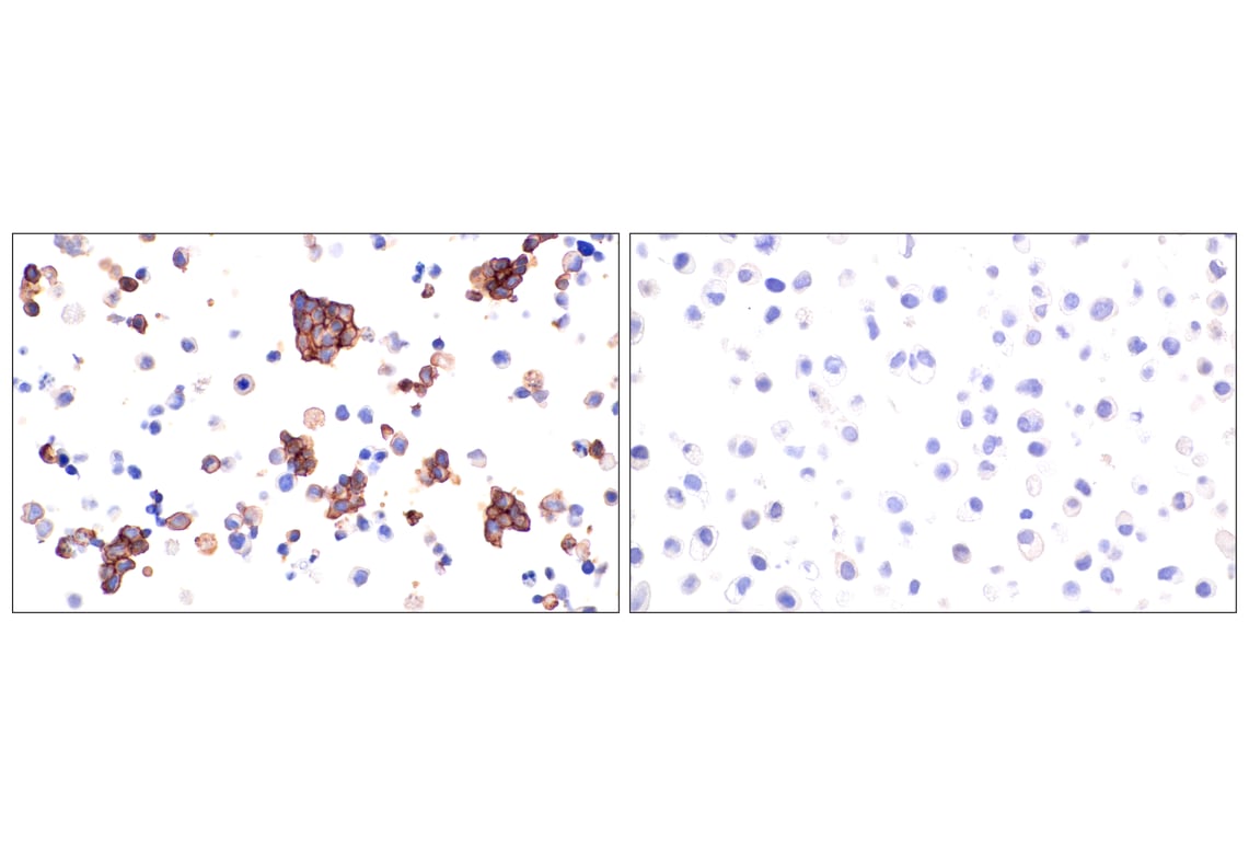 Immunohistochemistry Image 9: Claudin-5 (E5D9Y) Rabbit mAb