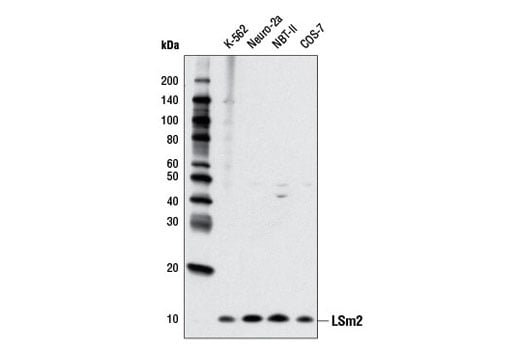 Western Blotting Image 1: LSm2 (D9X6C) Rabbit mAb
