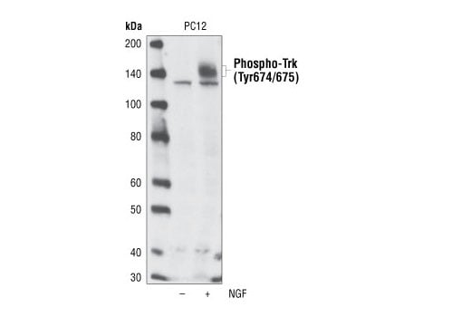 Western Blotting Image 2: Phospho-TrkA (Tyr674/675)/TrkB (Tyr706/707) (C50F3) Rabbit mAb