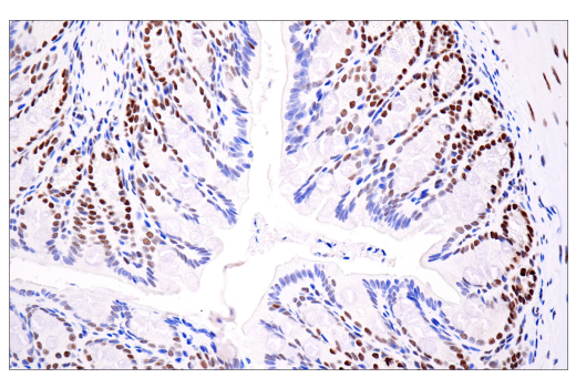 Immunohistochemistry Image 1: ATRX (E5X7O) Rabbit mAb (BSA and Azide Free)