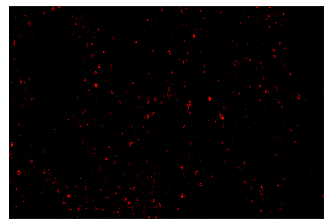 Immunohistochemistry Image 4: CTLA-4 (E2V1Z) & CO-0078-488 SignalStar<sup>™</sup> Oligo-Antibody Pair