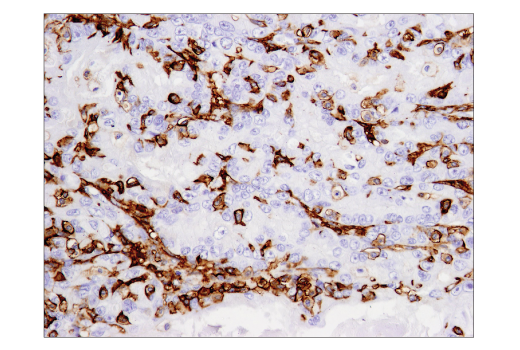 Immunohistochemistry Image 3: CD14 (D7A2T) Rabbit mAb (BSA and Azide Free)