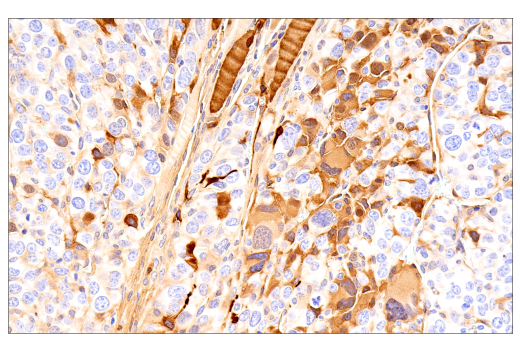 Immunohistochemistry Image 7: Parvalbumin (E8N2U) XP<sup>®</sup> Rabbit mAb