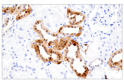 Immunohistochemistry Image 2: Parvalbumin (E8N2U) XP<sup>®</sup> Rabbit mAb