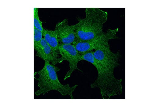 Immunofluorescence Image 1: p115 RhoGEF (D25D2) XP<sup>®</sup> Rabbit mAb