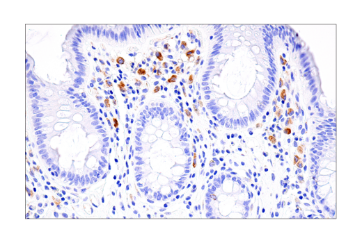 undefined Image 47: Human Reactive PANoptosis Antibody Sampler Kit