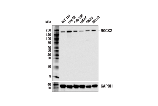 Western Blotting Image 1: ROCK2 (E5T5P) Rabbit mAb