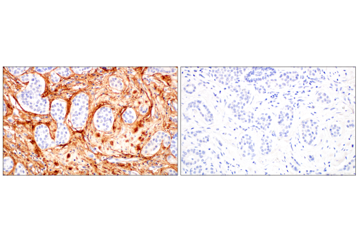 undefined Image 43: Extracellular Matrix Dynamics Antibody Sampler Kit